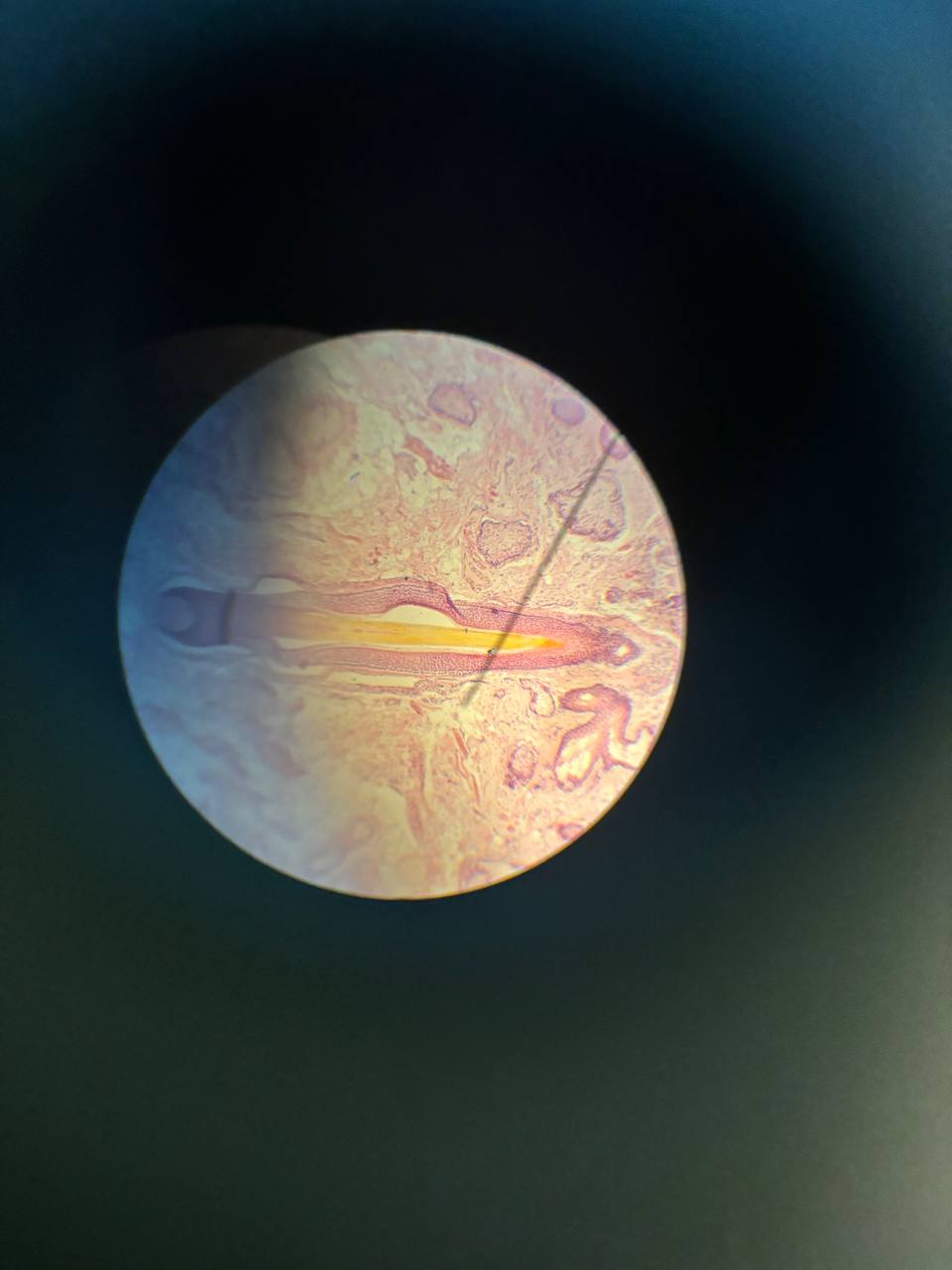 term image