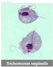 <p>Trichomonas vaginalis</p>