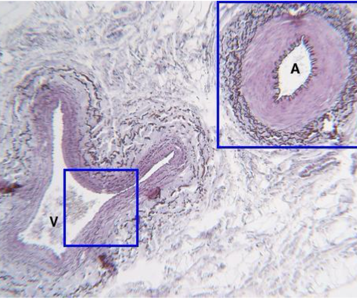 <p>what is being shown on the right **</p>