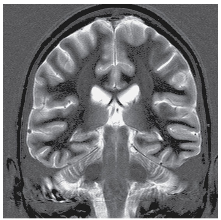 <p>What does this image show?</p>