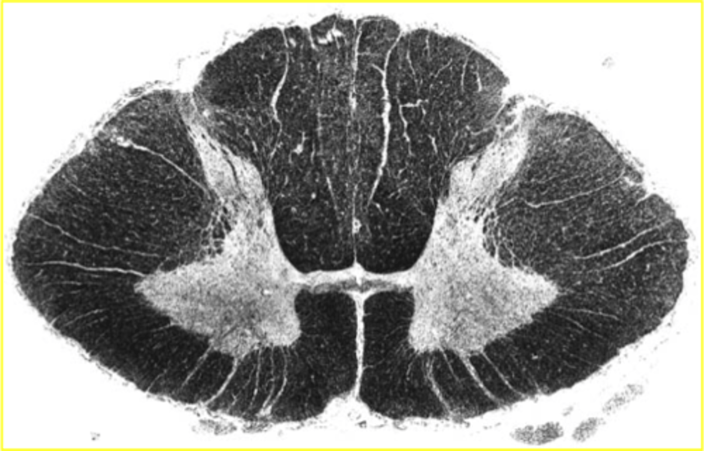 <p>large amounts of white matter; anterior grey horn is large</p>