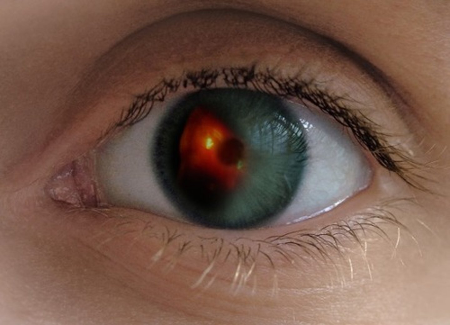 <p>the eye</p>