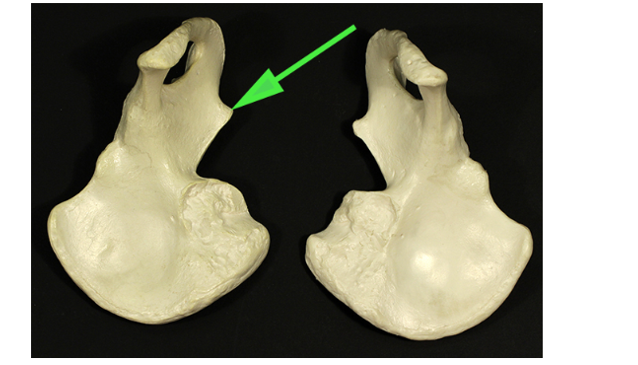 <p>What is the short, sharp projection of the bone marked by the green arrow?</p>