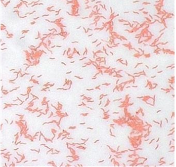 <p><span style="font-family: &quot;Segoe UI Semibold&quot;, sans-serif; line-height: 107%;"><span>Gram-positive, pleomorphic (pseudotuberculosis) or palisading (renale) filaments.</span></span></p>