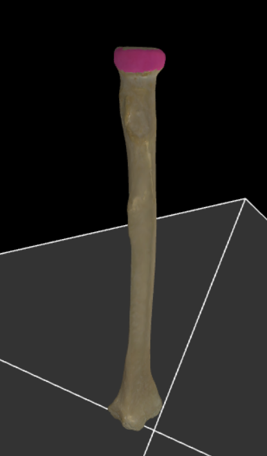 <p>Articulatievlak dat rondom het caput radii ligt voor articulatie met de incisura radialis van de ulna.</p>