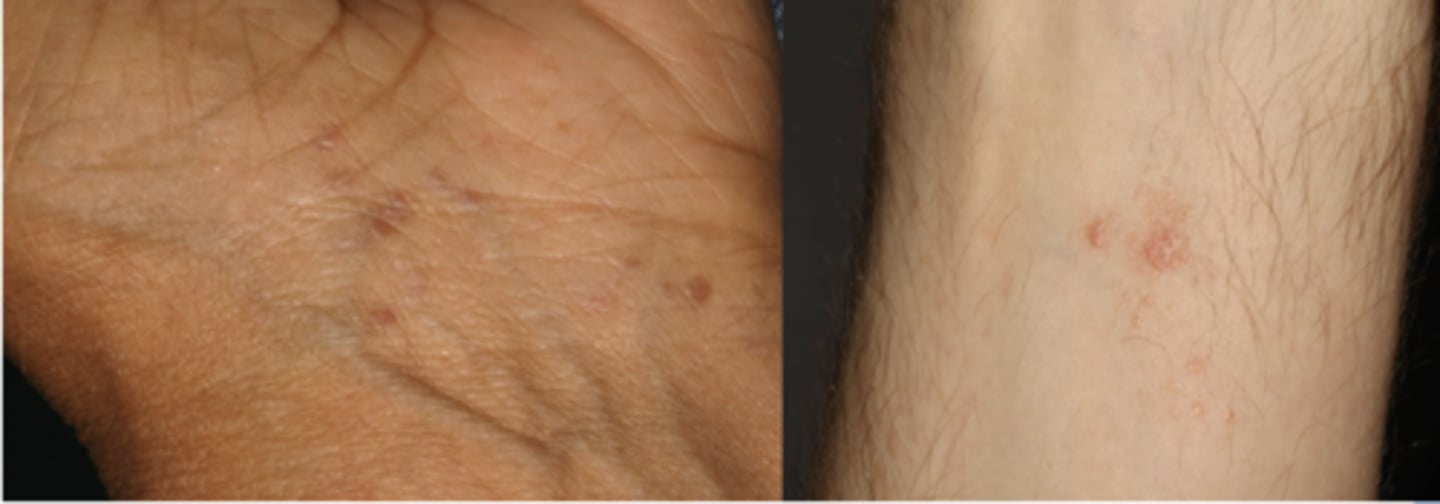 <p>What condition?</p>