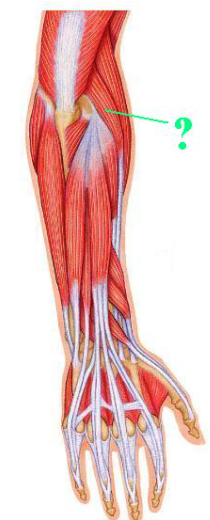 <p><span>Identify the indicated muscle.</span></p>