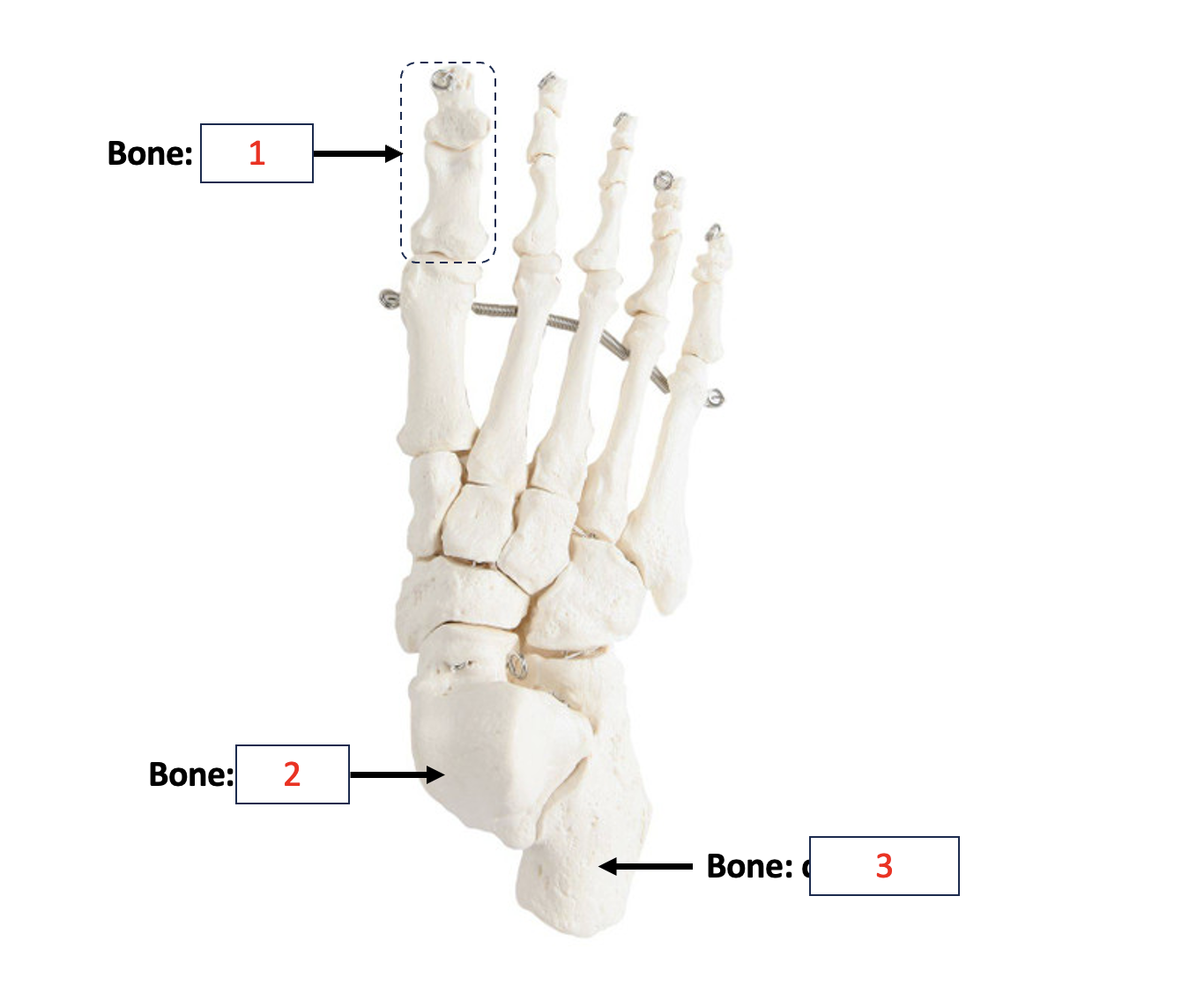 <p>Tarsals - Tallus</p>