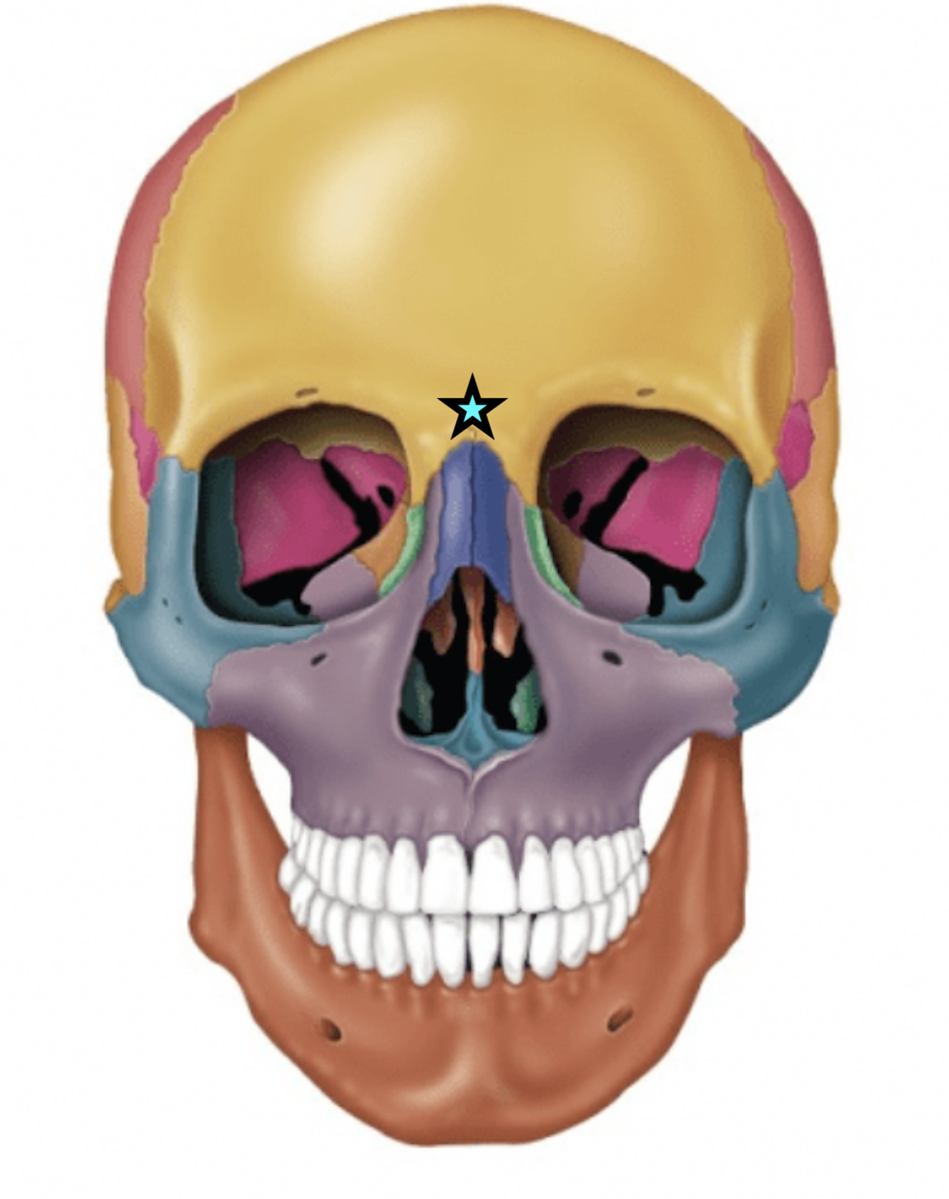 term image
