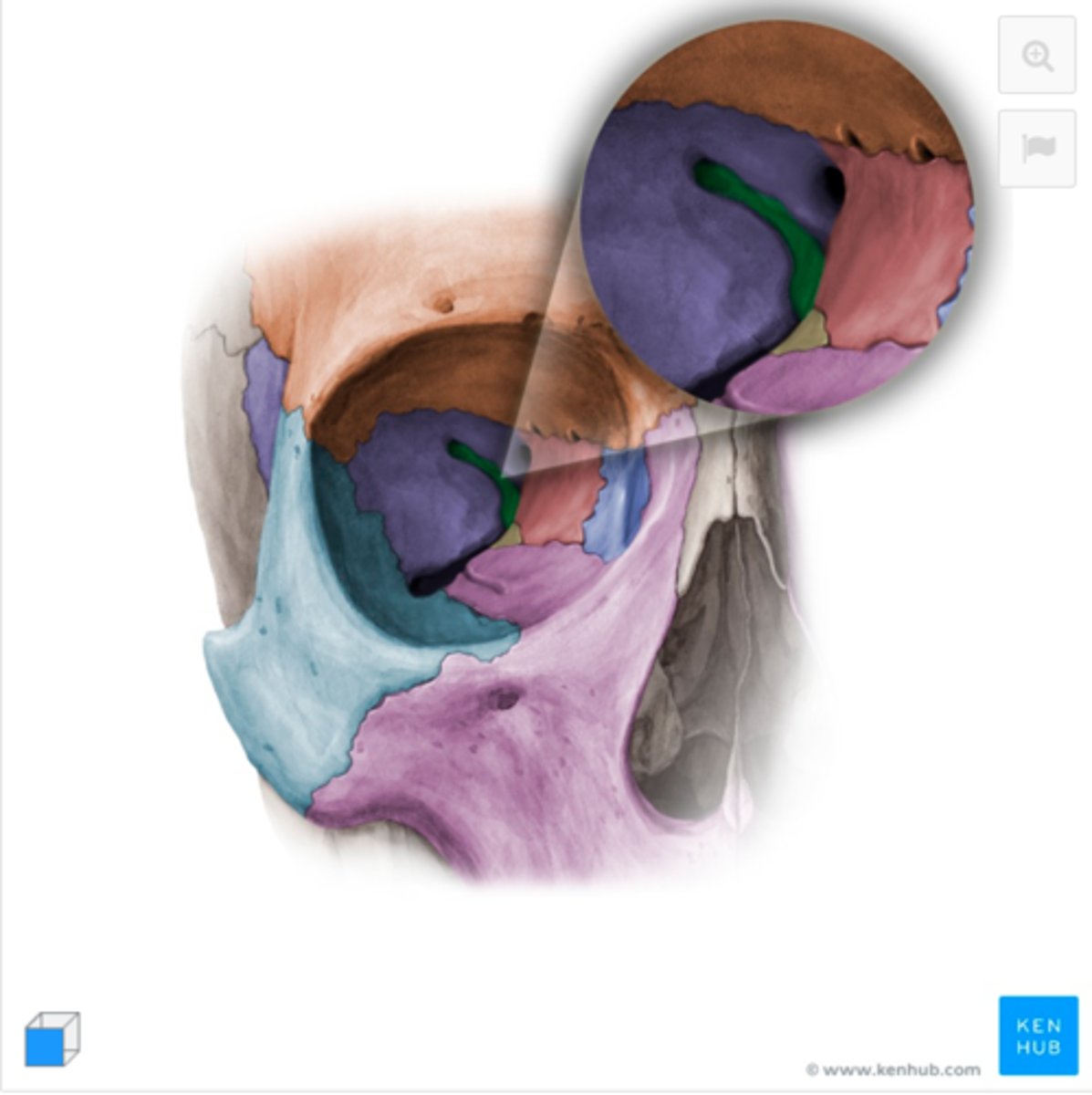 <p>Identify this structure:</p>