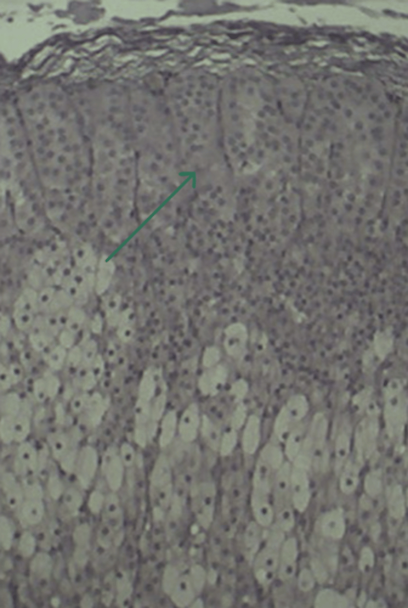 <p>gland and structure</p>