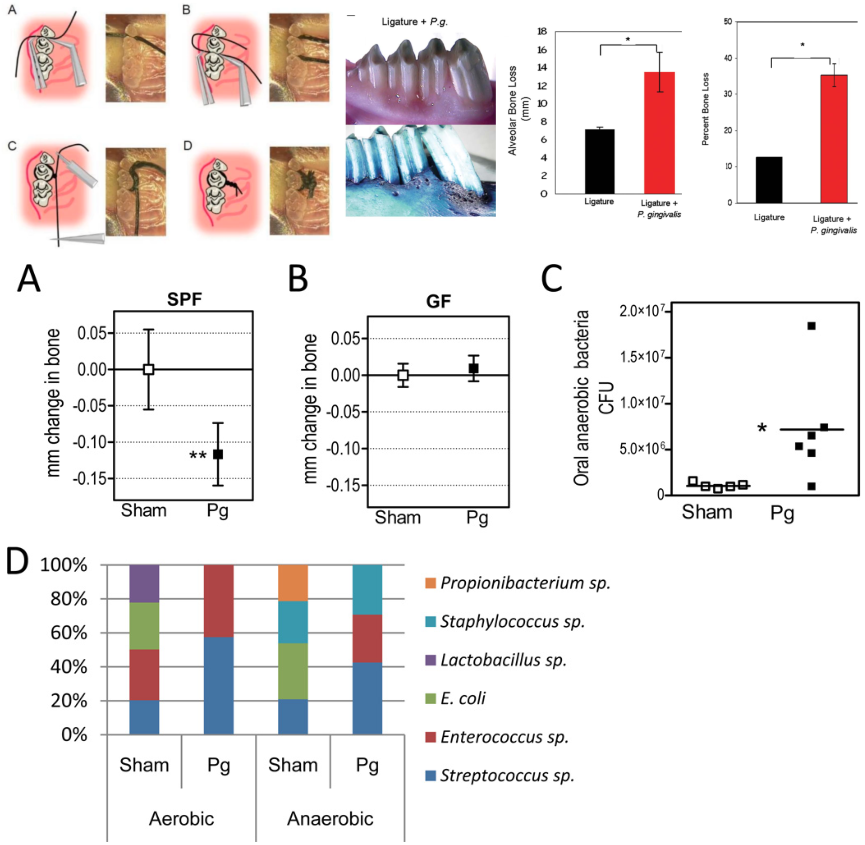 <p>it is a good example of the third postulate, also shows how porphyromonas gingivalis passes this postulate:</p><p>Shows a test showing how P. gingivalis can cause disease in mice and rabbits in a ligature-induced model(top) and how P. gingivalis can cause bone loss and a change in the microbial flora in mice (bottom half)</p><p></p><p>these tests basically show how the presents of P. gingivalis can cause bone loss and a shift in the CFUs for oral anaerobic bacteria&nbsp;</p><p></p><p>*for the study done in mice SPF - specific pathogen free mice (means they were never exposed to PG until the study was performed), GF - germ free mice (means after the mice were born were put in a bacteria free environment; never encountered bacteria, immune system never adapted to encounter bacteria)</p>