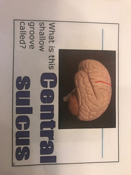 <p>separates frontal and parietal lobes</p>