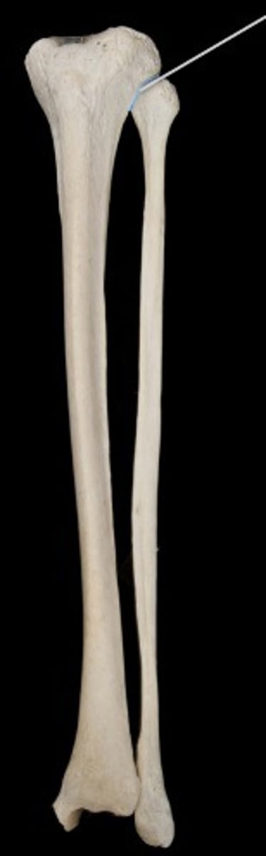 <p>Name the structure.</p>