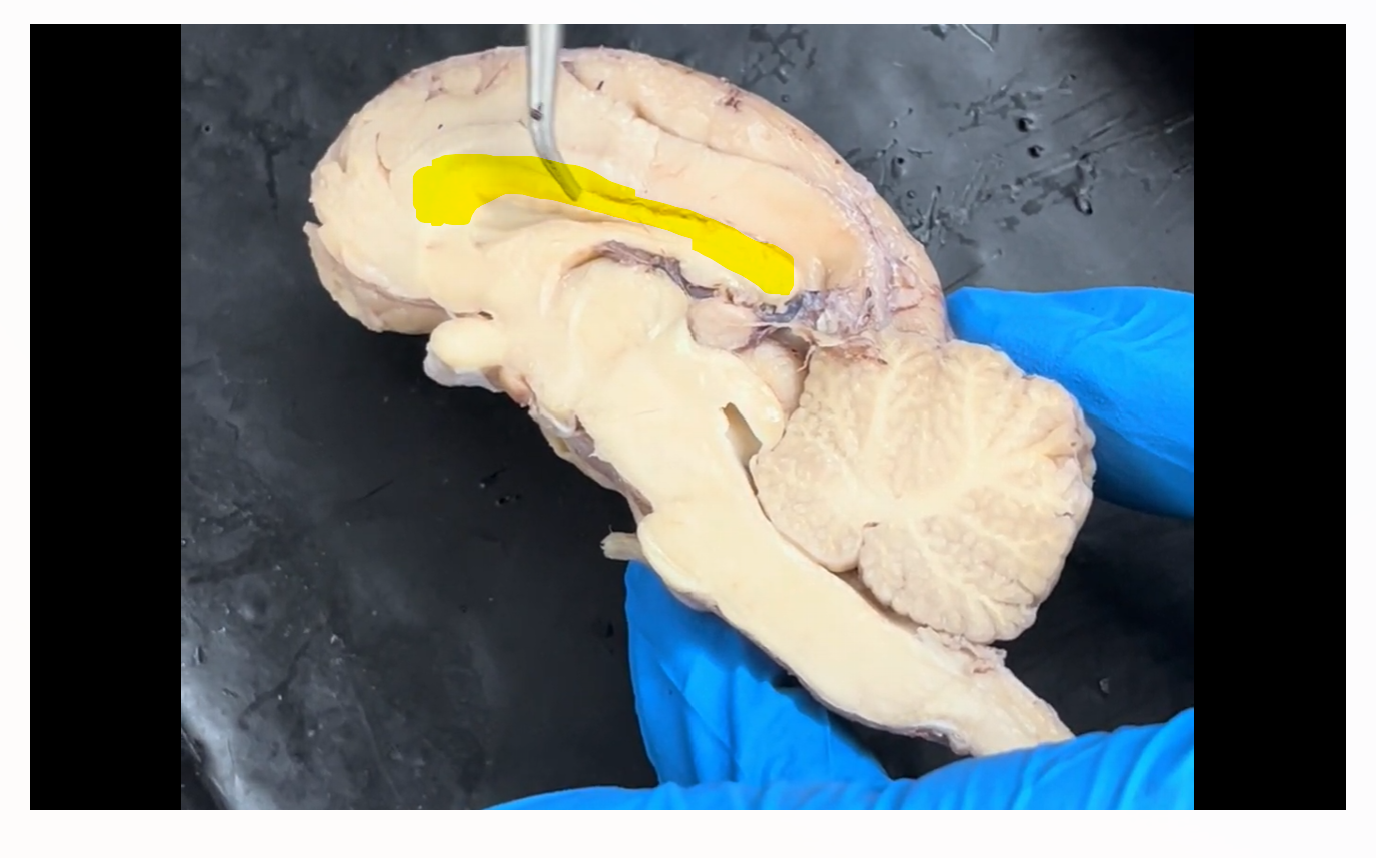 <p>Name the part of the brain highlighted in yellow.</p>