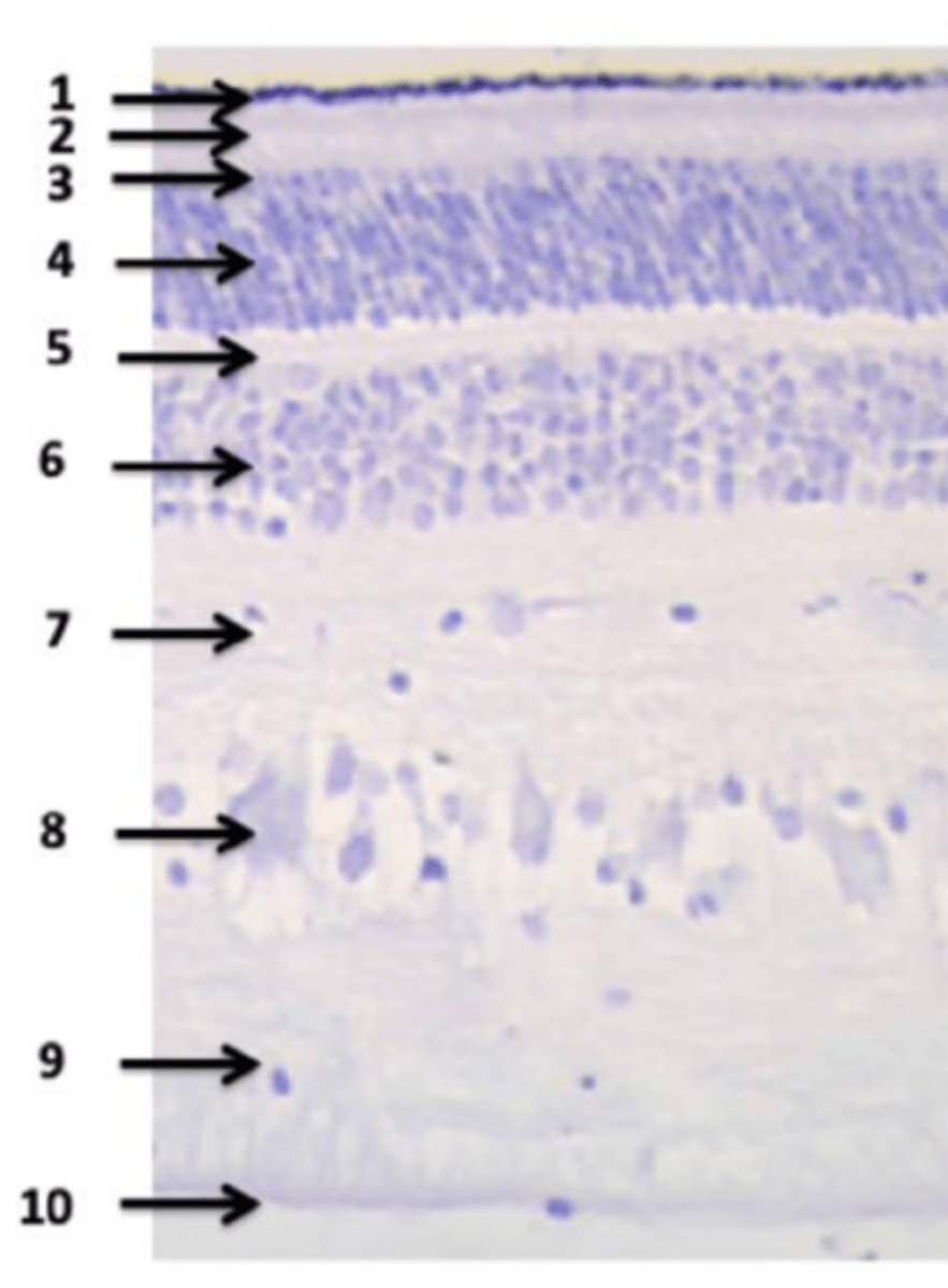 <p>#7</p>
