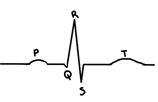 <p>Identify the event during P in the EKG/ECG</p>