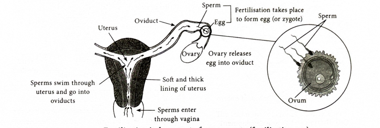 <p>Sperm enters through vagina and heads towards the oviduct passing through the vagina. If there is a egg in the oviduct and the sperm is able to enter the eggs then it is fertilised, both nuecli fuse to form a single neucli and making a zygote.&nbsp;</p>
