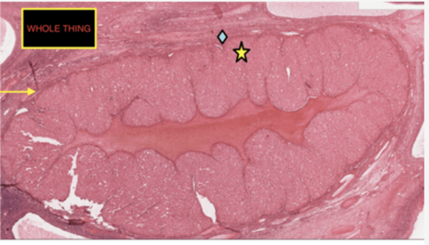 <p>Identify the structure</p>