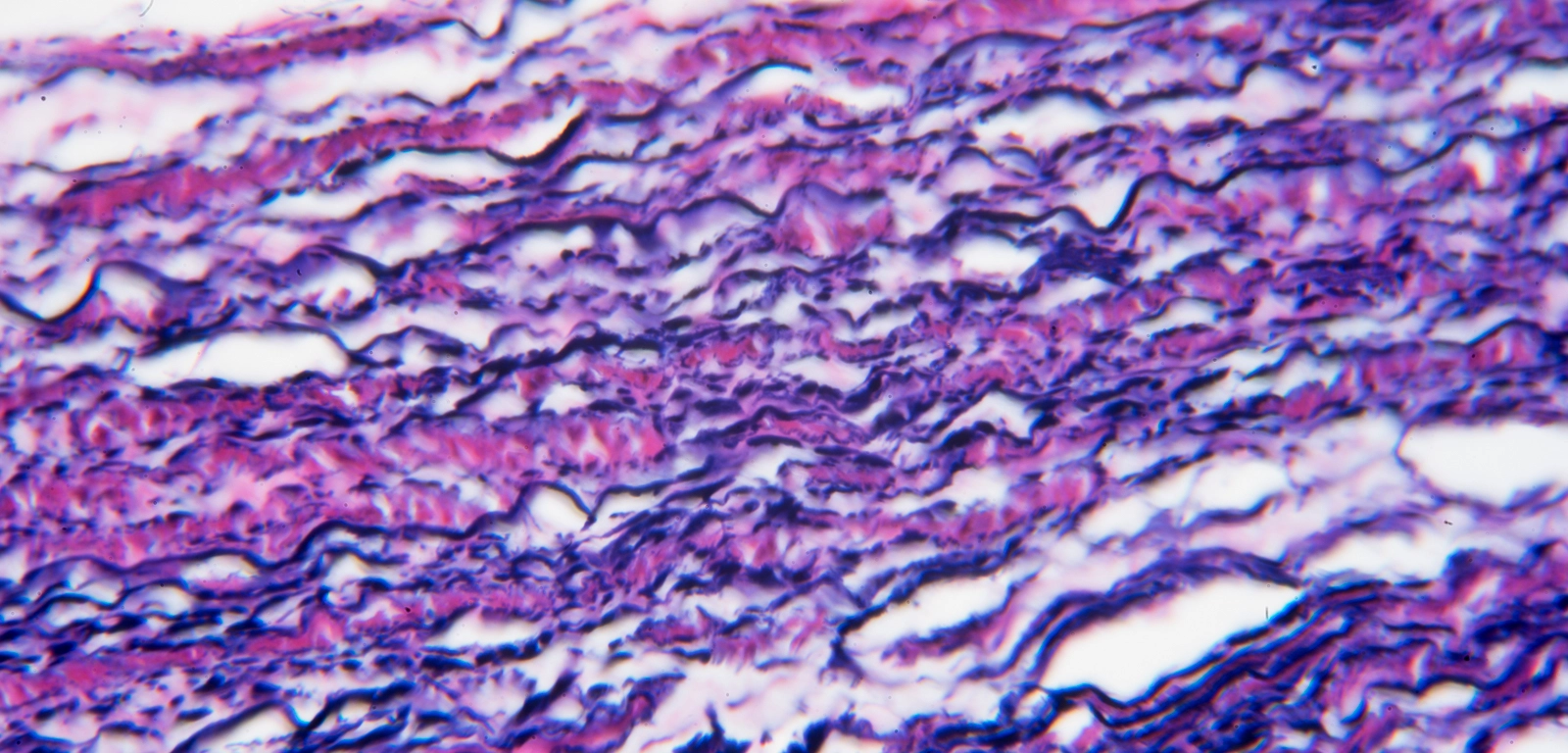 <p>Location and function of elastic connective tissue</p>