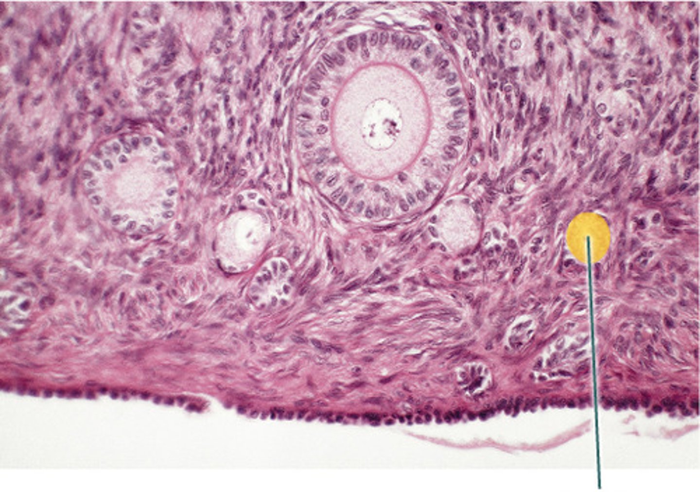 <p>primordial follicles</p>