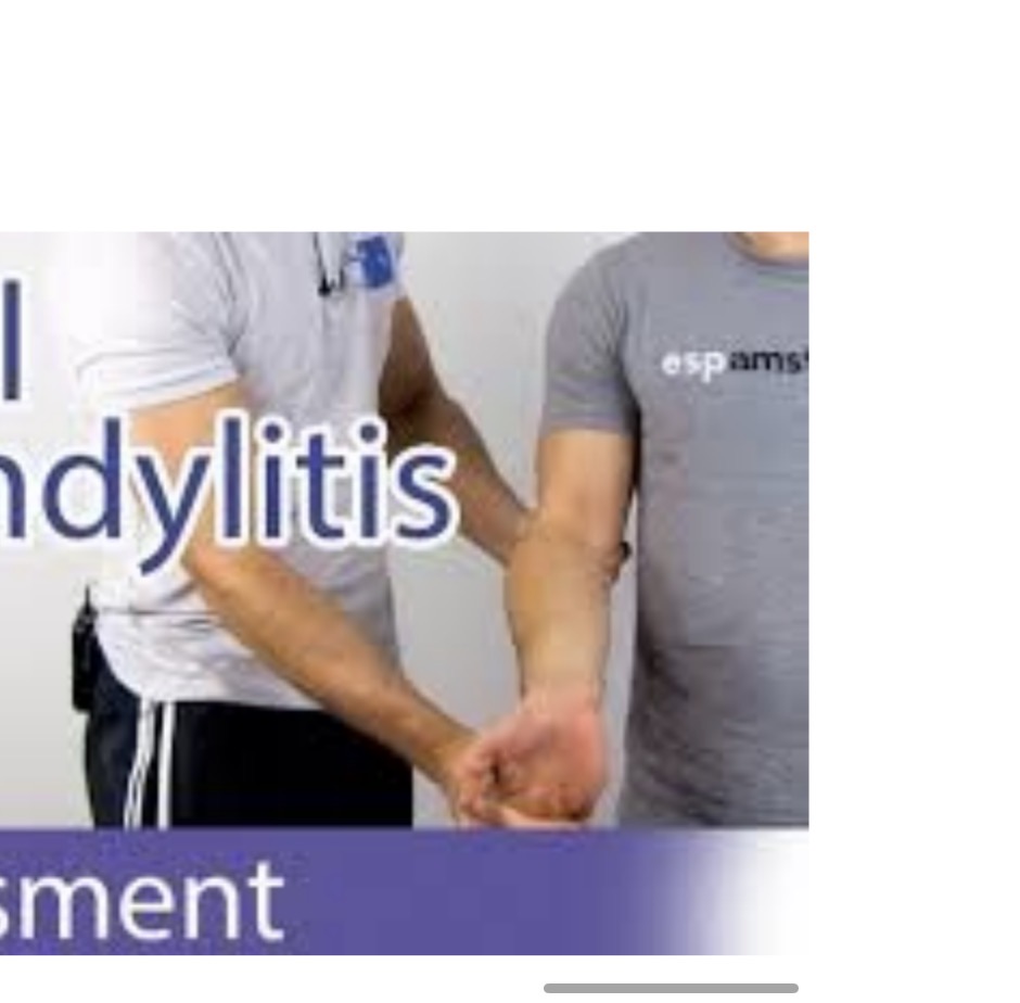 <p>A test where resisted flexion is applied while palpating the medial epicondyle to assess for medial epicondylitis.</p>