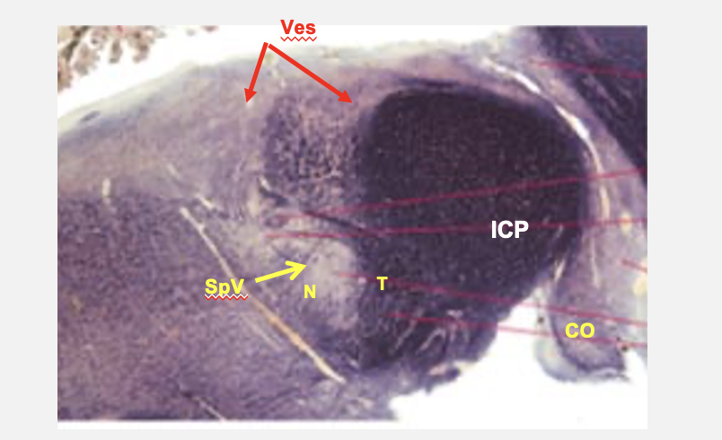 <p>ponto-medullar junction cross section structures&nbsp;</p>