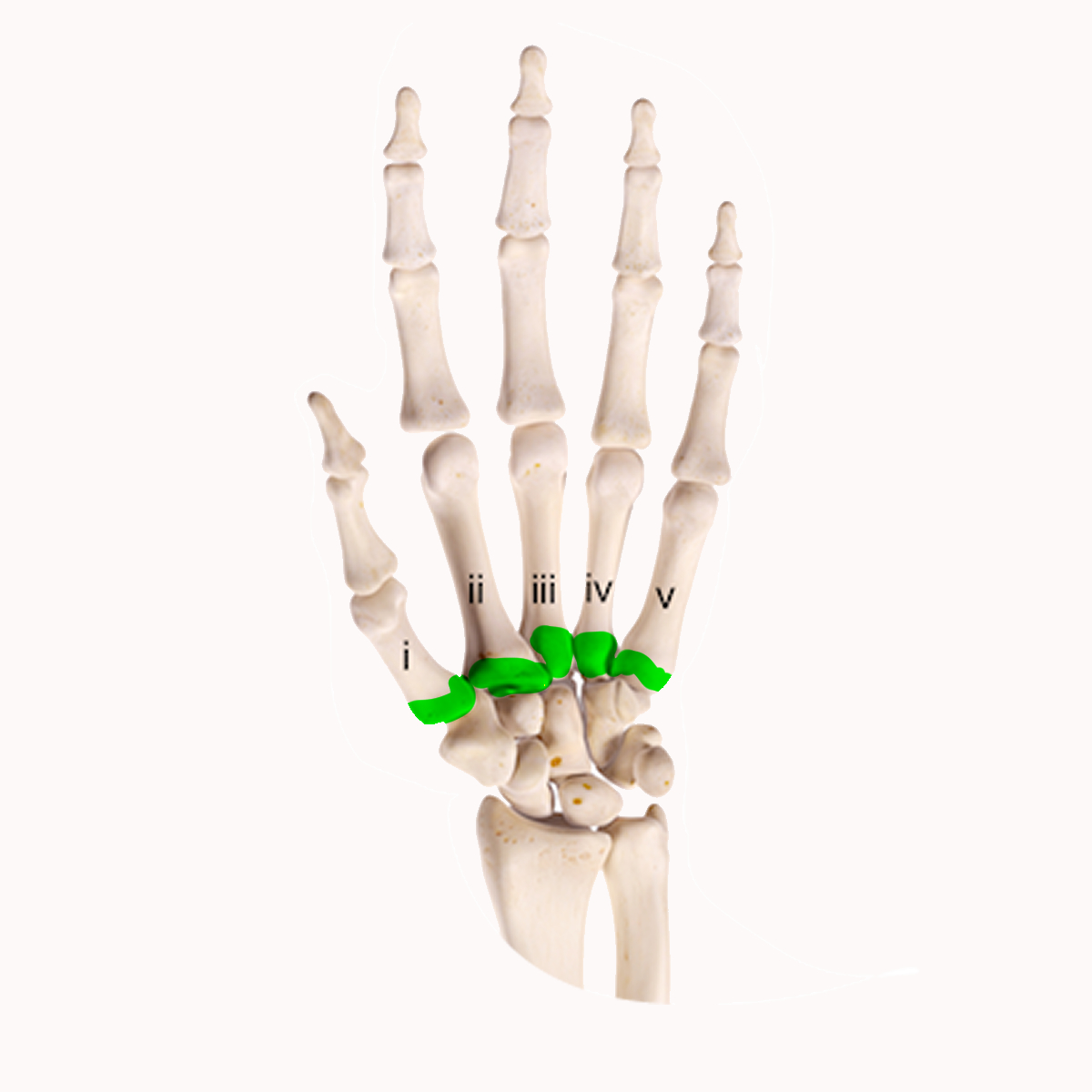 <p>The the highlighted part of the metacarpal</p>