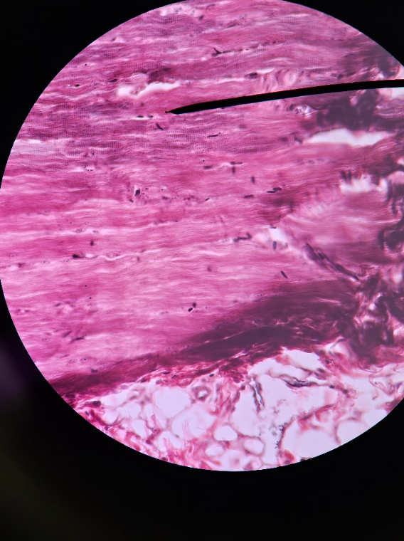 <p>VOLUNTARY MUSCLE</p><ul><li><p>many tightly packed rows of squiggly lines of cells</p></li><li><p>darker in color (purplish)</p></li><li><p>tube-like format</p></li><li><p>very coarse and rough looking </p></li></ul><p></p>