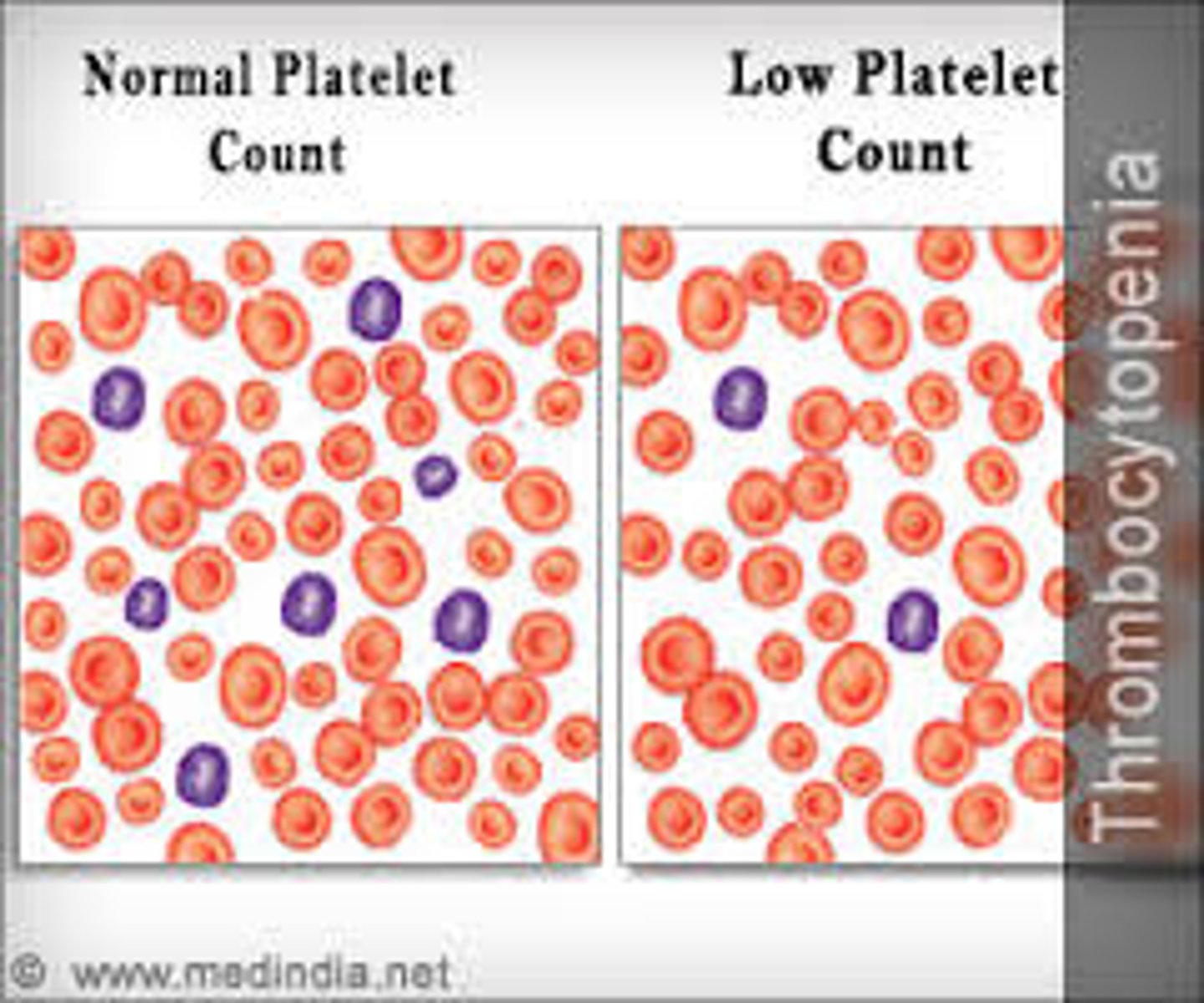 <p>low platelet count</p>
