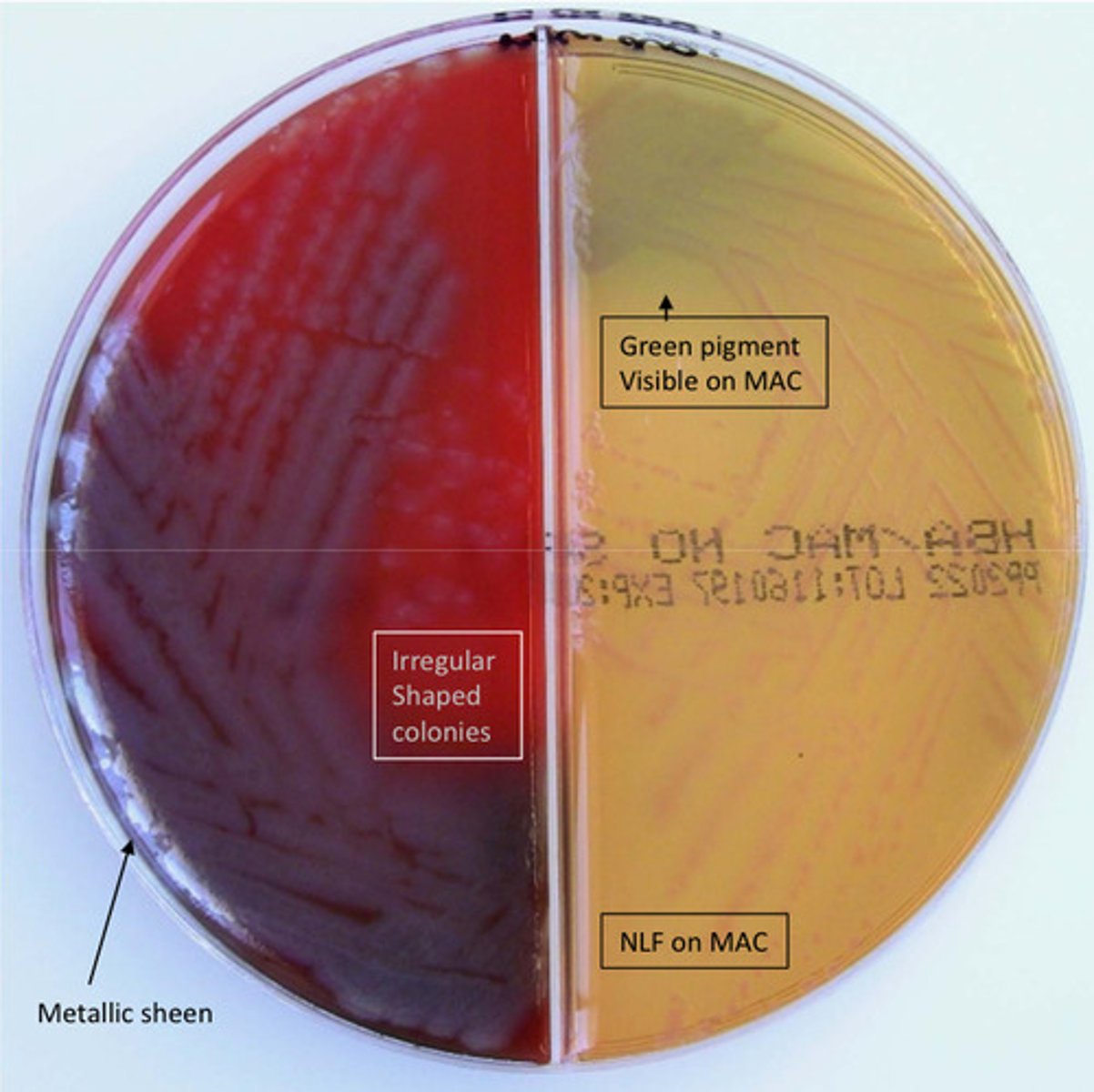 <p>GNB, catalase pos, oxidase pos, lactose neg, green pigment, metallic sheen on BA, grape odour, very resistant on sensitivity</p>