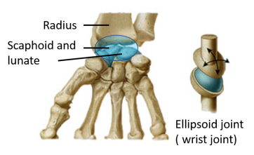 <p>What joint type is this?</p>
