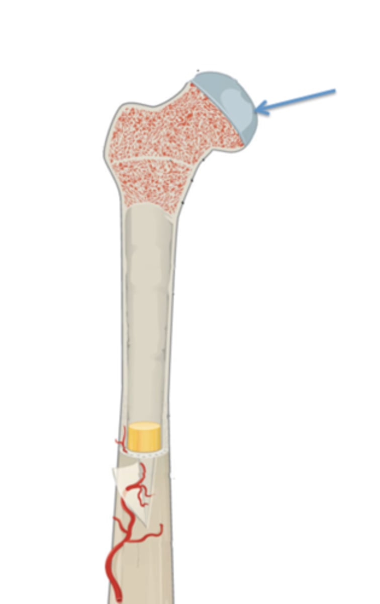 <p>What is the name of this hyaline cartilage structure?</p>