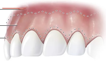 <p>Mondslijmvlies</p>