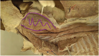<p><span>Epaxial Muscles (Neck region)</span></p><p><span>(Innervated by dorsal branches of spinal nerves)</span></p>