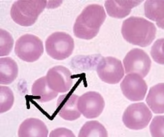 <p><span>platelets</span></p>
