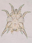 <p>What Parasite Is This?</p>