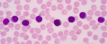 <ul><li><p>size varies</p></li><li><p>dense nuclear chromatin</p></li><li><p>round-oval nucleus</p></li><li><p>blue cytoplasm</p></li><li><p>± azurophilic granules</p></li></ul><p></p>