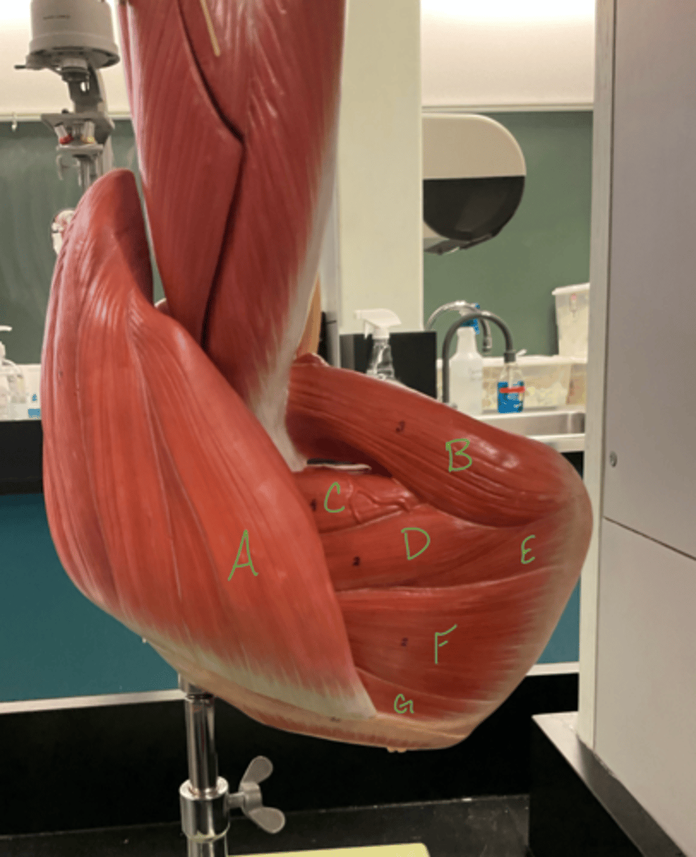 <p>infraspinatus</p>