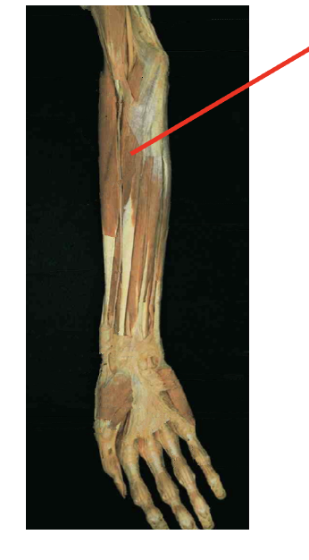 <p>What is this muscle? What is its origin? Where is its insertion</p>