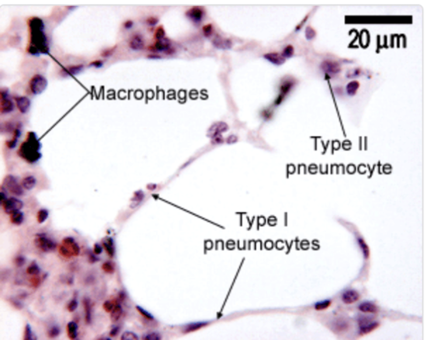 <p>are specialized immune cells in the alveoli of the lungs. Are the first line of defense in the respiratory tract, maintaining sterility in the alveolar spaces.</p><p>They also play a role in the clearance of dead cells and recycling surfactant components.</p>
