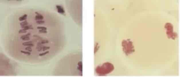 <p>Splitting of the pairs of homologous chromosomes and subsequent movement to opposite poles</p>