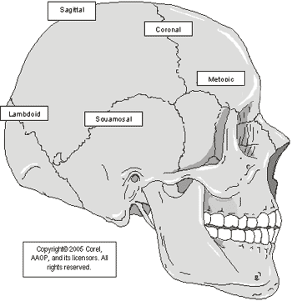 <p>Lateral</p><p>Superior</p><p>- Coronal suture</p><p>- Sagittal suture</p><p>Posterior</p><p>- Lambdoid structure</p>