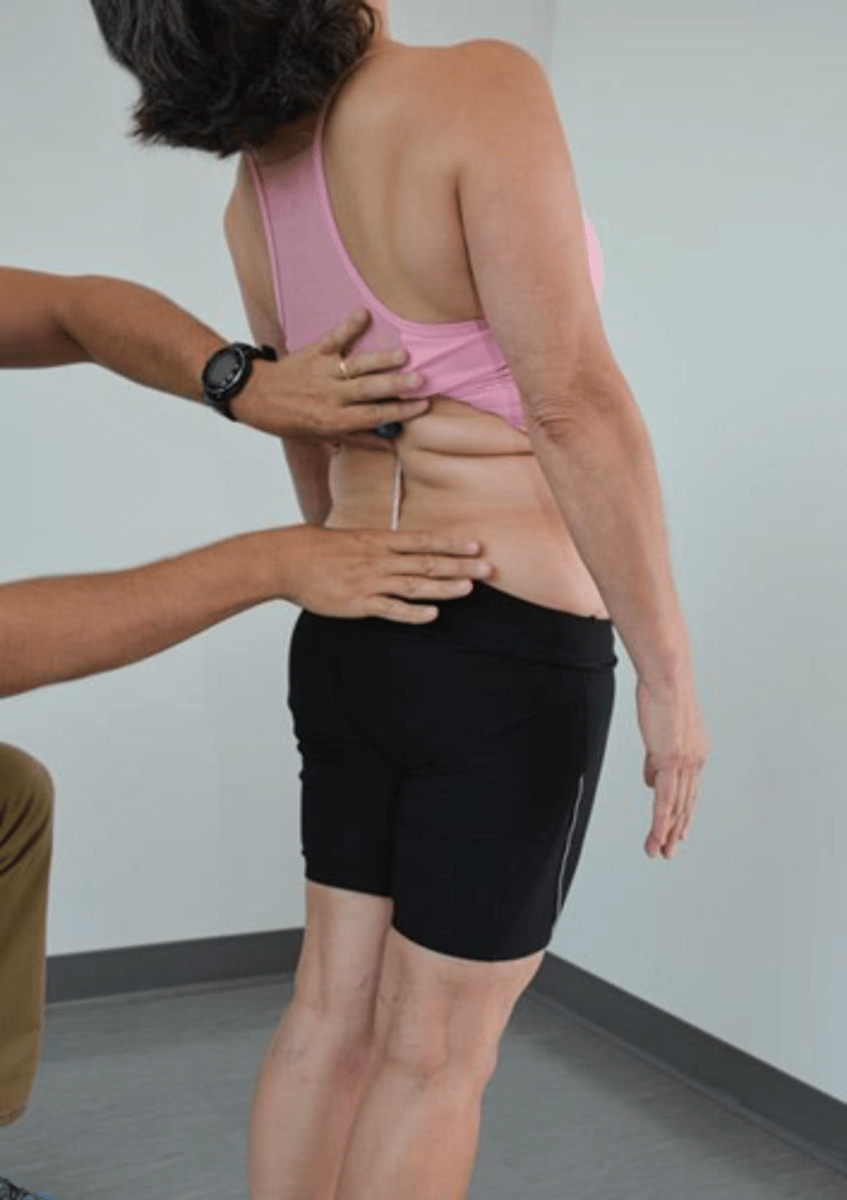 <p>standing</p><p>superior point: T12 (end of ribs) </p><p>inferior point: S2/PSIS </p><p>measure from T12-S2, extend trunk, measure difference (shorter) </p>