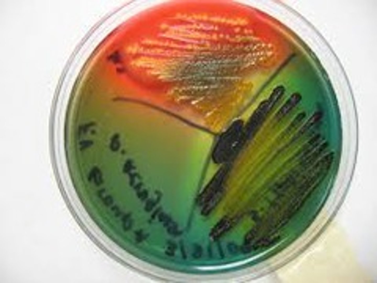 <p>HEA- Hektoen Enteric Agar</p><p>1a. lactose</p><p>1b. sodium thiosulfate (produces iron sulfide and forms black centers in the colonies if produced hydrogen sulfide)</p><p>2. bile salts</p><p>3. bromothymol blue</p><p>4. blue/ green colonies; non lactose fermenter</p><p>5. orange/ coral colonies; lactose fermenter</p><p>6. selective and differential media</p>