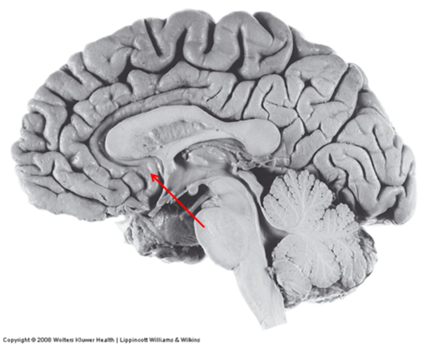 <p>inferior to genu of corpus callosum</p>