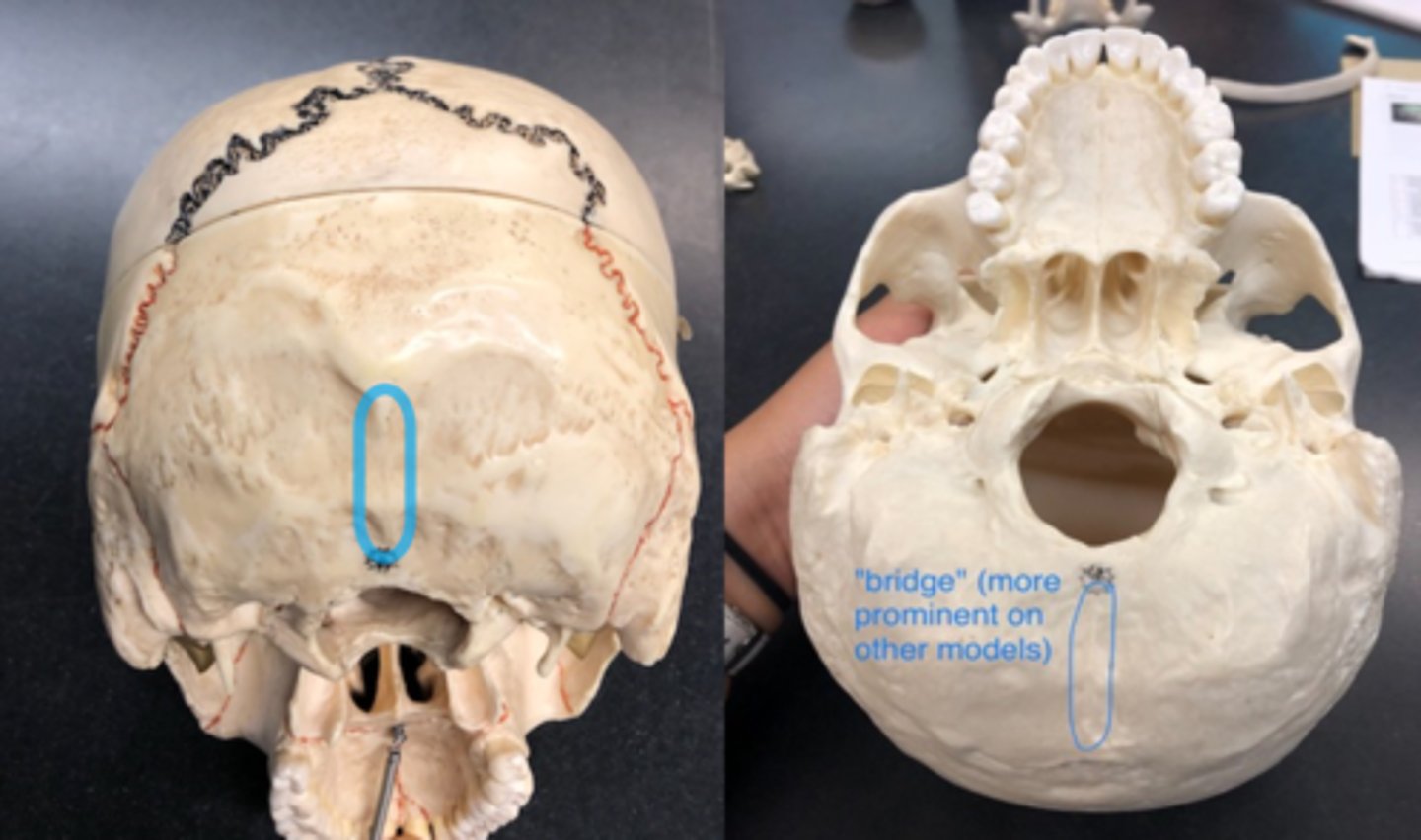 <p>Bridge leading to foramen magnum (outside view of skull)</p>