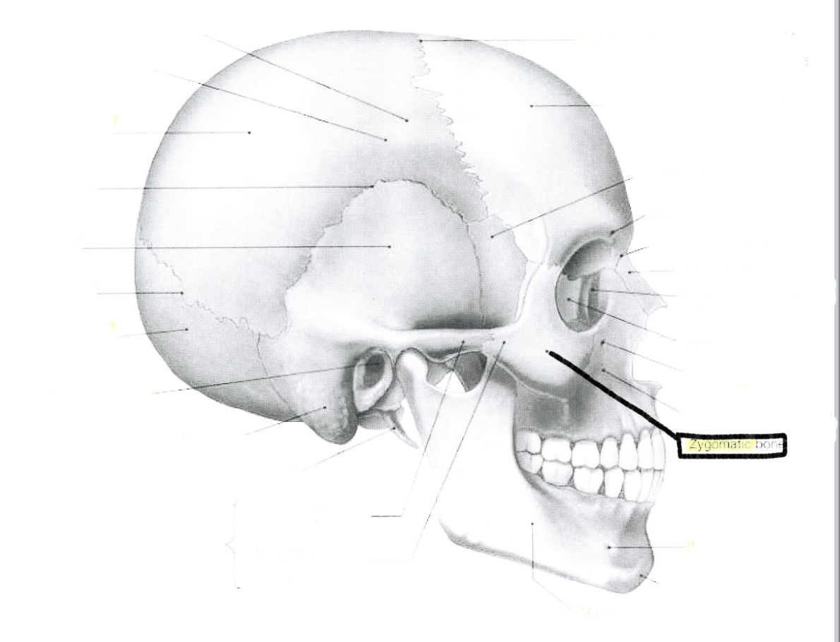 <p>Zygomatic bone</p>