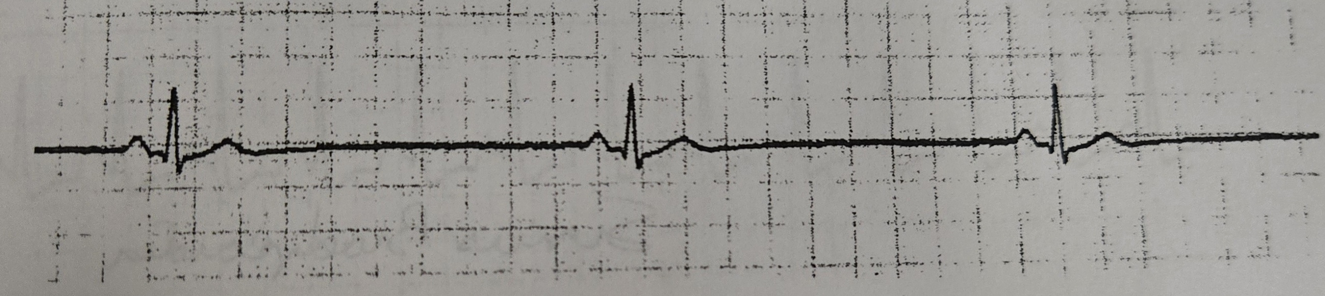 <p>What Rhythm is this?</p>