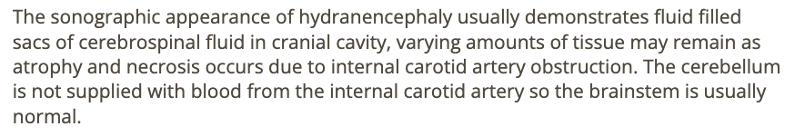 <p>b) fluid filled sacs of cerebrospinal fluid in cranial cavity, varying amounts of tissue may remain as atrophy + necrosis occurs</p>